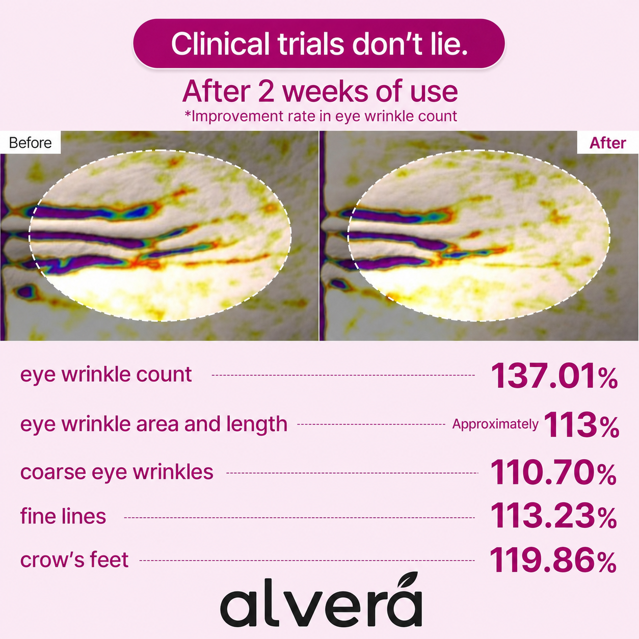 Clinical trial results after two weeks of use