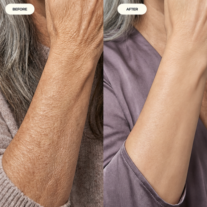 HA Hydrating Body Serum - Crepey Arms Formula
