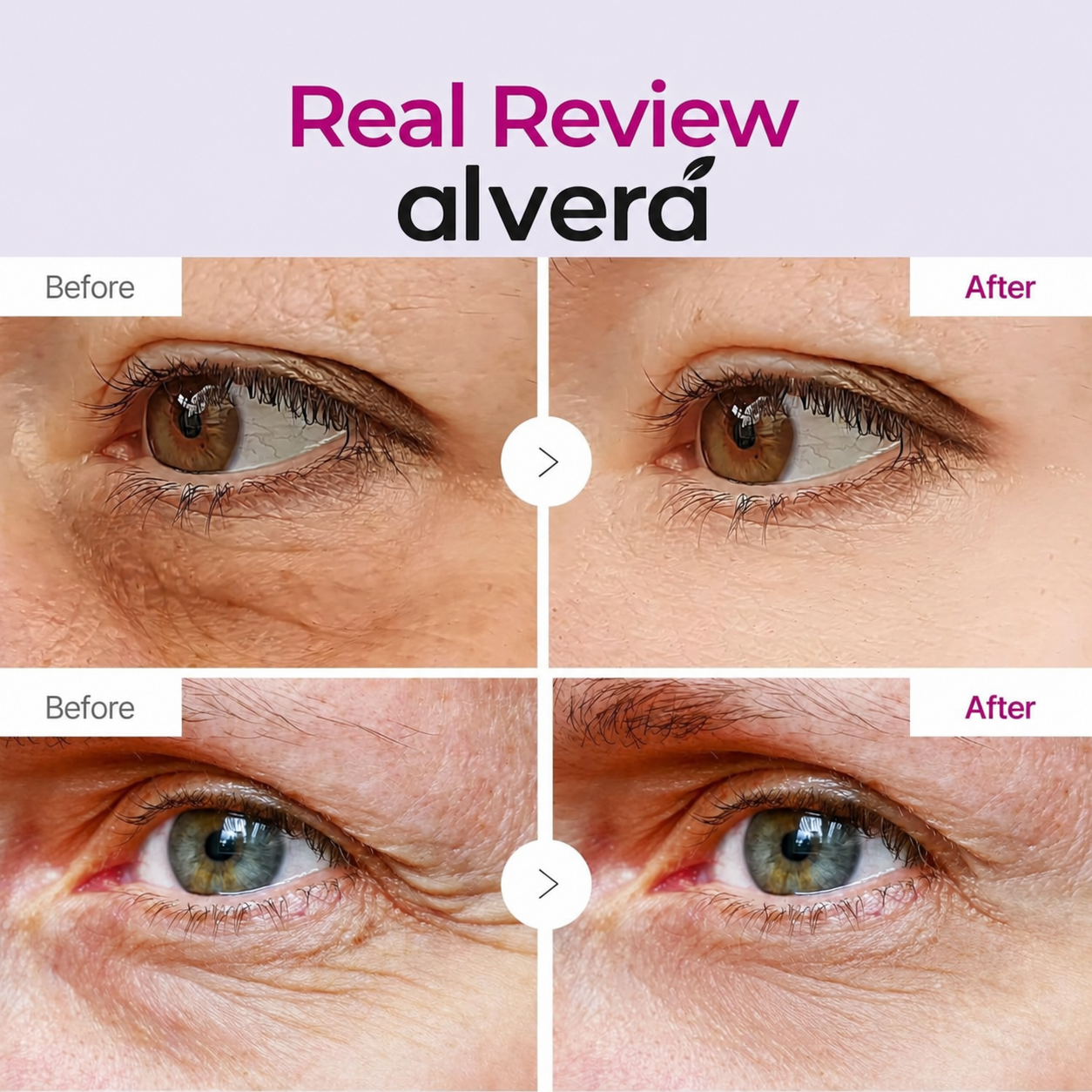 Real review before and after around the eyes