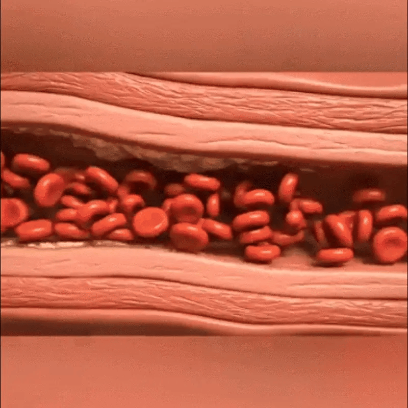 Red Yeast Rice Cholesterol Cleanse